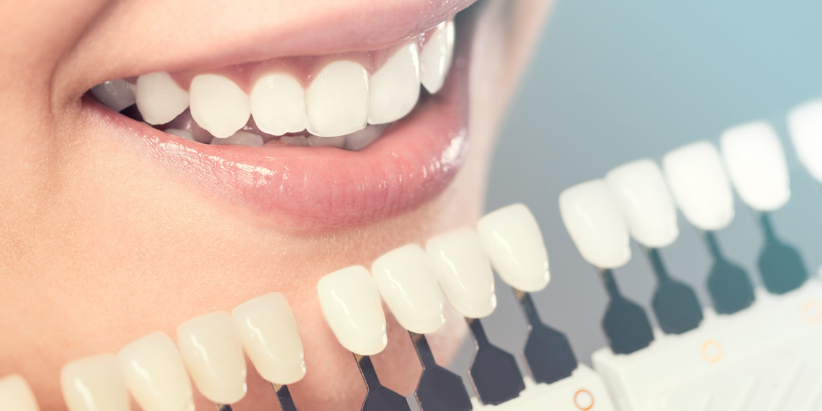 Preserving Smiles: The Benefits of Dental Sealants in McKinney, Texas