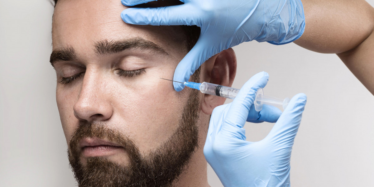 Everything You Need to Know About a Beard Transplant