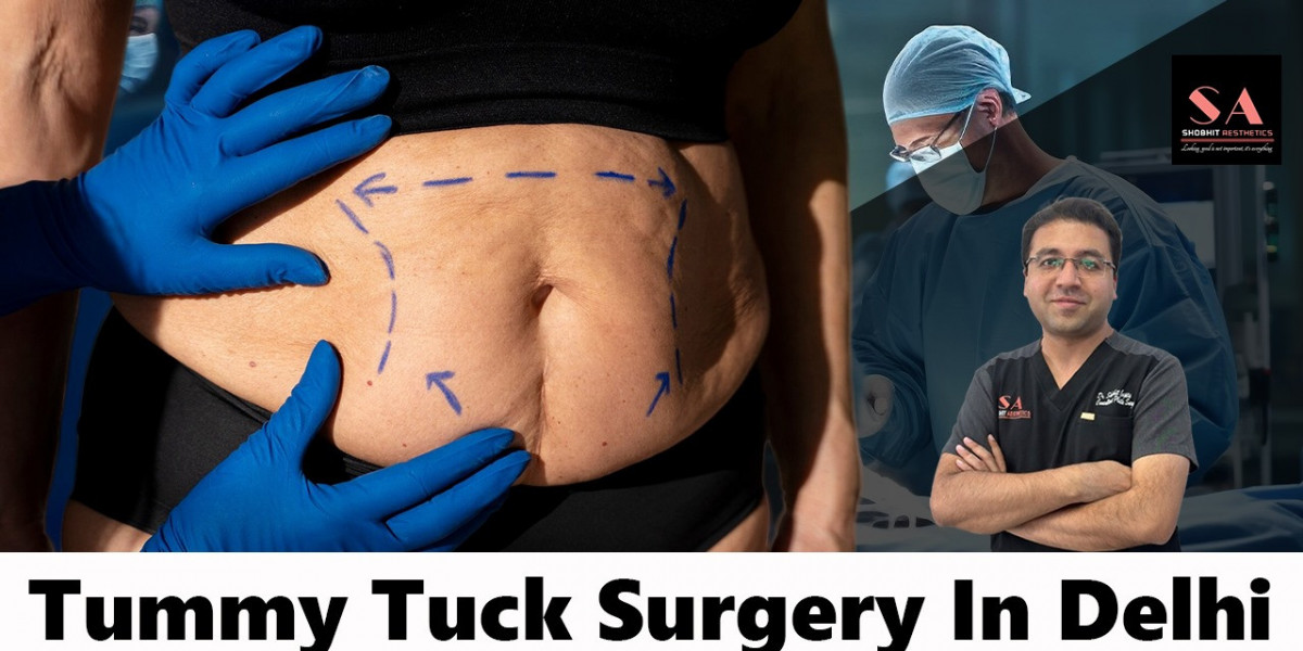 What is a 360 tummy tuck?