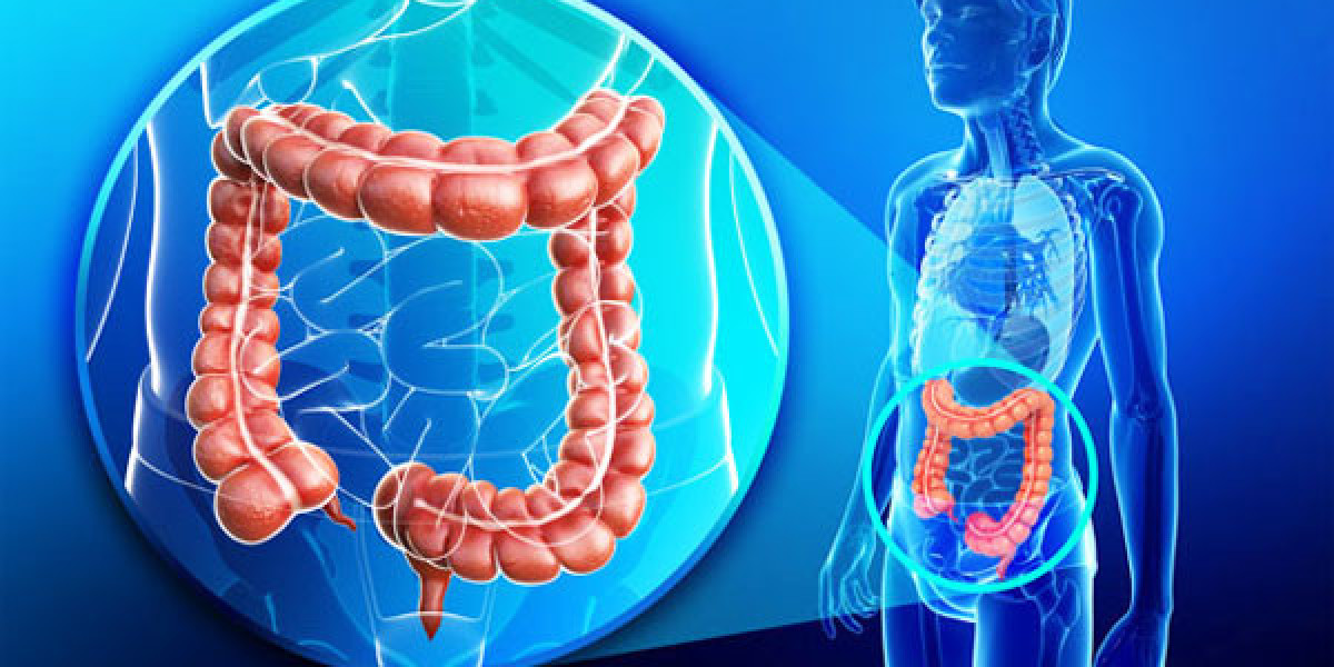 Colorectal Surgery in Delhi: Excellence Under Dr. Neeraj Goel